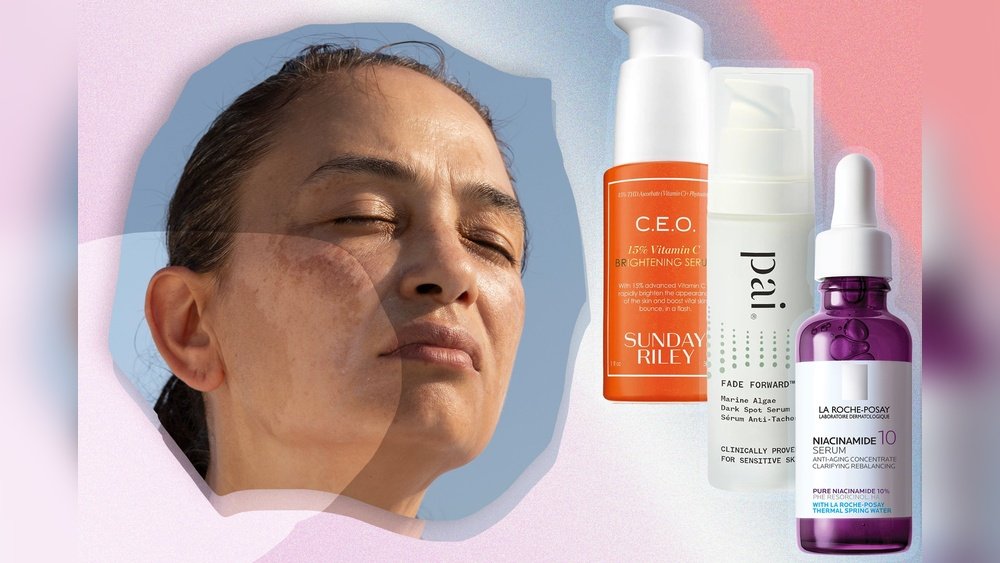 Best Moisturizer for Post-Inflammatory Hyperpigmentation