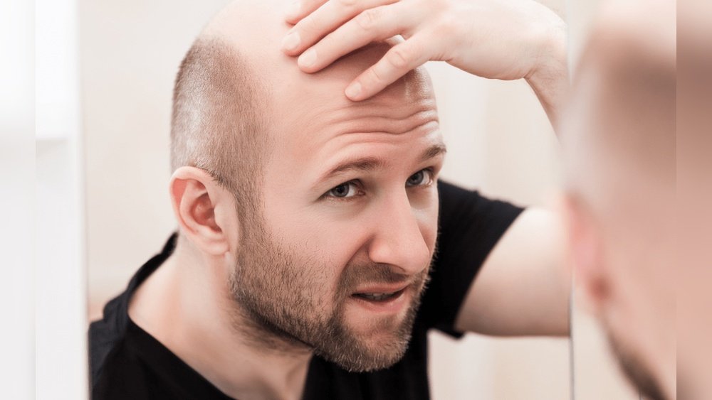 Hair Loss Genetic Testing: Can Your Dna Predict Thinning Hair Loss Genetic Testing: Can Your Dna Predict Thinning