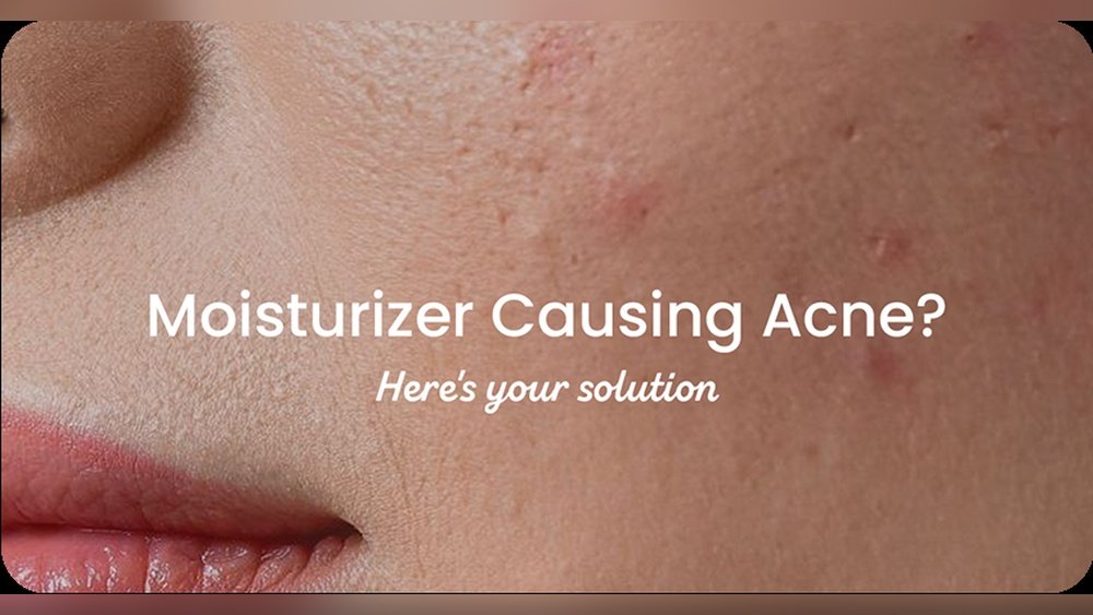 Heavy Moisturizer in Humid Climate Causing Breakouts: What to Do Heavy Moisturizer in Humid Climate Causing Breakouts: What to Do
