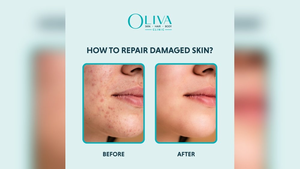 How to Repair Your Damaged Skin Barrier Naturally: Complete Protocol How to Repair Your Damaged Skin Barrier Naturally: Complete Protocol