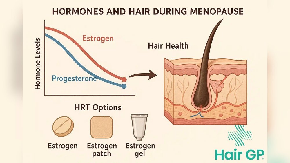 Menopause Hair Loss And Dht Sensitivity: The Estrogen Connection Menopause Hair Loss And Dht Sensitivity: The Estrogen Connection