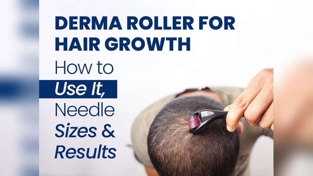 Scalp Microneedling for Hair Growth: Dermaroller Guide And Schedule