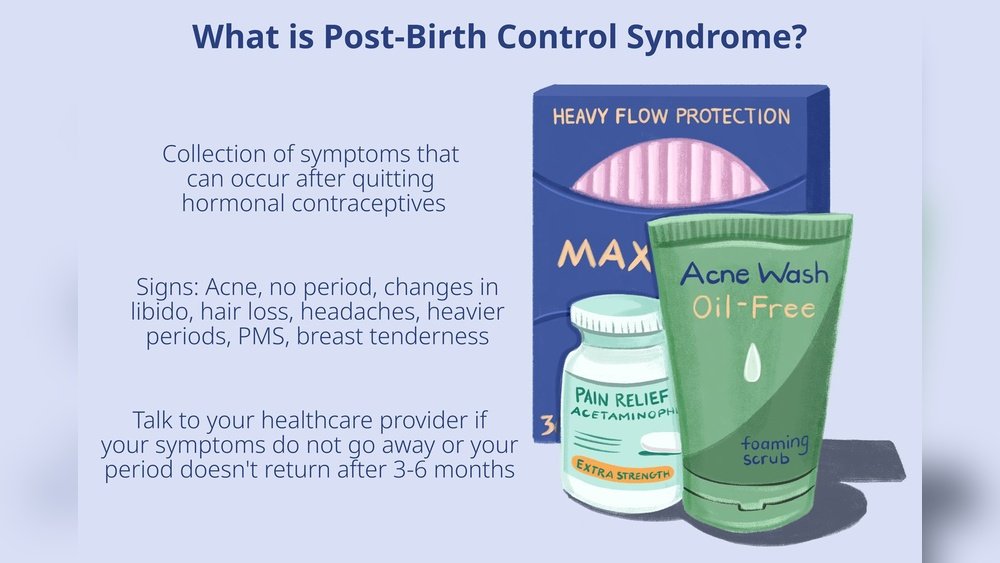 Stopping Birth Control Hair Loss: The Hormonal Rebound Effect Stopping Birth Control Hair Loss: The Hormonal Rebound Effect