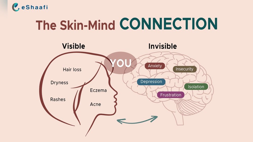 The Connection Between Mental Health And Skin And Hair Conditions