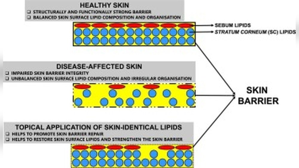 Water And Lipid Function in Skin Barrier: Moisture Vs Fat Balance Water And Lipid Function in Skin Barrier: Moisture Vs Fat Balance