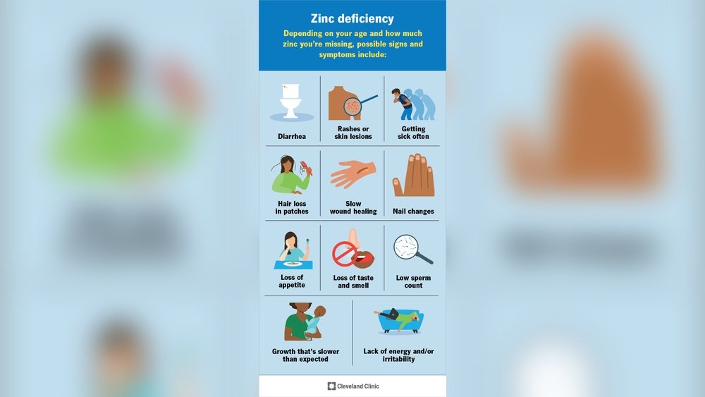Zinc Deficiency Signs in Hair And Skin: Dosage And Food Sources Zinc Deficiency Signs in Hair And Skin: Dosage And Food Sources